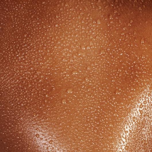 CM SkinPen Microneedling (3) 